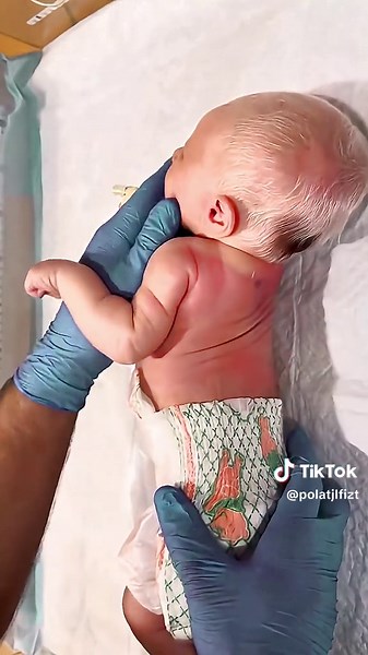 White Newborn Baby Complete Head-to-Toe Examination for Beginners #newborn #hospital #N Part 8 #tiktokgrowthchallenge #critical_case😭😭🏥