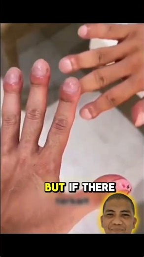 This Simple Finger Test Could Reveal Hidden Health Problems! 🩺