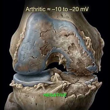 The Wear and Tear Lie (Arthritis) | Dr. Adam Sewell MD