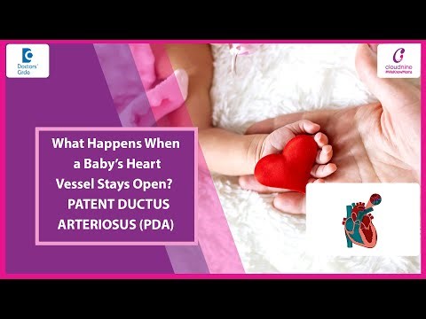 Hole in Baby’s Heart | Silent Heart Problem in Newborns | PDA - Dr. Vimal Kumar U | Doctors' Circle