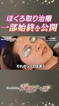 【閲覧注意】「人間が焼ける匂い…」顔中のホクロを除去した一部始終