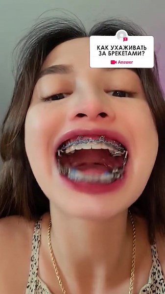 Брекеты за 12.990₽, как за ними ухаживать? ⠀ Рекомендации по уходу после установки системы. ⠀ • Налить машинное масло на зубную щетку и тщательно смазать систему. Стоп ❌ это была шутка 😂 читай рекомендации :👇🏼 ⠀ Конструкция для ортодонтического лечения установлена и уже начался процесс коррекции прикуса. Теперь необходимо соблюдать советы ортодонта. Грамотный ежедневный уход обеспечит целостность корректирующей системы, а также Вы поддержите хорошее состояние зубов. ⠀ Соблюдайте рекомендации: