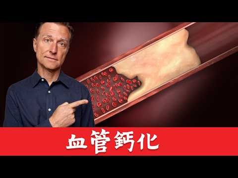 血管鈣化,硬化的真正原因,自然療法,柏格醫生 Dr Berg