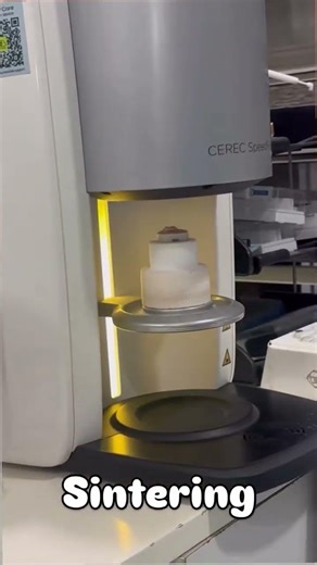 How to Fix Worn Teeth Without Full Crowns | CEREC Digital Overlay #shorts