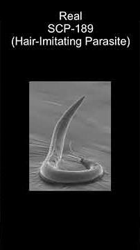 SCP-189 | Hair-Imitating Parasite (SCP Library)