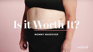 2.2K views · 25 reactions | Is a mommy makeover worth it? RealSelf Verified doctor and board-certified plastic surgeon Dr. Dana Khuthaila shares which procedures are typically included in mommy makeovers, how long surgery takes, and what the recovery is like. Watch the full video to learn about the pros and cons of a mommy makeover. Find the right mommy makeover provider for you: https://bit.ly/3Hx9JZe | RealSelf | Facebook