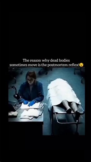 फैक्ट⚡️⚡️ on Instagram: "Dead bodies can move-and it's pure science, not a ghost story! It's called the Postmortem Reflex. Even after the brain stops, residual electrical energy in the muscles can cause sudden twitches or limb movements. As the body undergoes Rigor Mortis, chemical changes stiffen the muscles, but later, as gases build up during decomposition, they can physically shift limbs or even create "groaning" sounds as air escapes the throat. It's a chilling but natural part of biology t