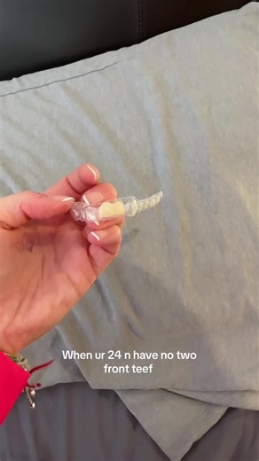 Dealing with Missing Teeth as a Young Adult