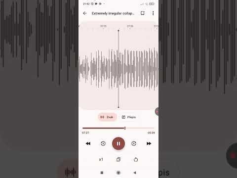 Extremely irregular & fast collapsing heartbeat under a lot of pressure.