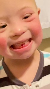 68K views · 3.8K reactions | We have had a lot of loose teeth around our house lately and last night Milo lost his second tooth! It was so unbelievably loose I was afraid it was going to fall out overnight and then he’d swallow it. So Daddy stepped in and completed the extraction. . And trust me when I tell you that you do NOT want to miss the surprise in this video. No spoilers. Just watch! . #twinlife #twinswithdownsyndrome #reallifewithtwins #looseteeth | Chuckles and Meatloaf | Facebook