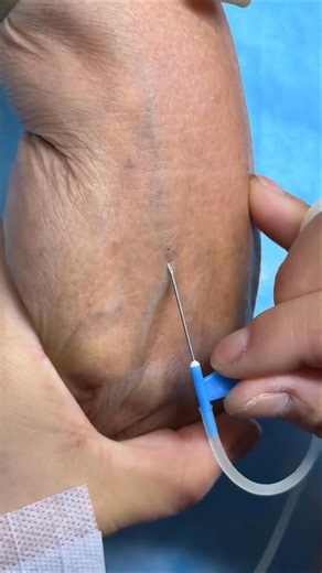 How to Give IV Injection Safely | Intravenous Nursing Skills | Perfect IV & Intramuscular IM #shorts