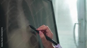 Doctor looking at lungs scan x-ray image on digital tablet. The Doctor hands with medical x ray of chest scan. doctor examine human lungs on Chest X-ray scan.