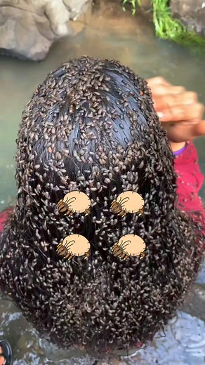 Bu Böcekler Kafa Derisi Mi Yiyor? 😲😱 | Enescelikyt