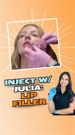 Natural Lip Enhancement With Julia | Custom Lip Filler Using Juvederm & Vollure