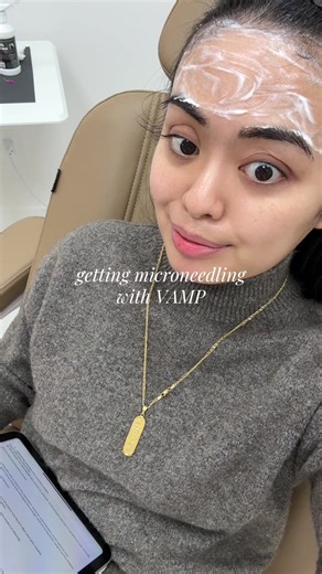 Microneedling with VAMP: Revitalize Your Skin