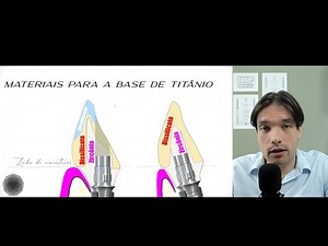 Zircônia e Dissilicato sobre o Tibase
