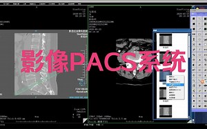 医院PACS影像信息管理系统源码带三维重建