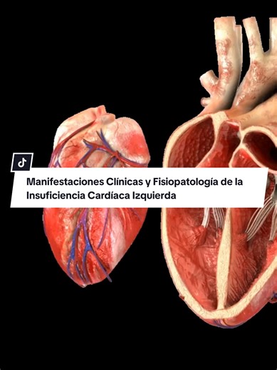 Curso Virtual de Insuficiencia Cardíaca: Aprende a Abordar