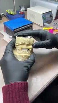 How are dentures made.