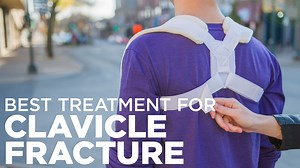 BraceAbility Clavicle Brace for Collarbone Support and Posture Correction, Adjustable Shoulder Alignment Strap, White, Medium