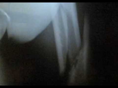 Why a bodybuilder shouldn't engage in arm wrestling - commando training (part 2 of 2)