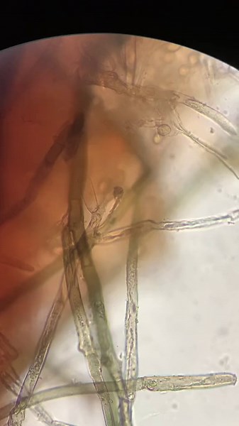 Do You Cut Around the Mold? Exploring Fungi Under the Microscope