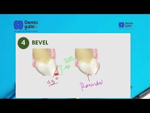 Bevel tricks for class IV