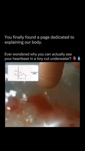 Explaining Our Body on Instagram: "When you place a small finger wound in water, the blood doesn’t just diffuse — it pulses. That pulsing matches your actual heartbeat. This happens because every time your heart contracts, it sends a surge of pressure through your arteries and capillaries. Even a tiny injury becomes a window into your circulatory system. What you’re seeing is the rhythmic pressure wave created by each beat of the heart. When the wound is submerged, water acts as a magnifying med