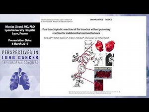 Carcinoids, large cell neuroendocrine carcinoma, thymoma and thymic carcinomas