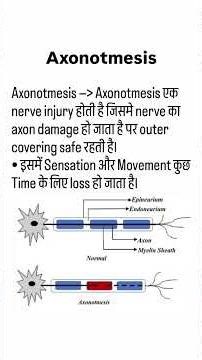 Axonotmesis – Nerve Injury Explained #doctor
