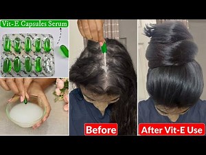 I applied👆🏼this Vitamin-E Hair Mix-Hair Growth got Tripled-Increase Hair Density, Thickness & Length