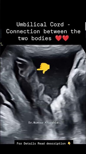 Umbilical Cord: Role, Functions, and Importance During Pregnancy Explained