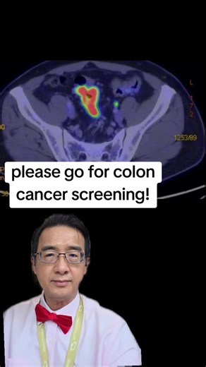 https://www.healthhub.sg/well-being-and-lifestyle/personal-care/screening_colorectal_cancer_nuhs www.drdesmondwai.com #drdesmondwai #韦俊韬 #singaporecancersociety #coloncancer #screening