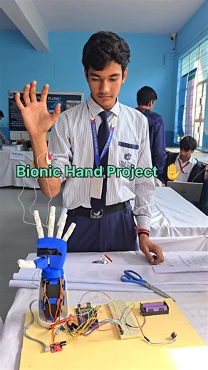 Dr Ambedkar lab foundation (NGO) | Bionic Hand Project ✋️ #ambedkarlab #ngo #stem #arduino #innovation | Instagram