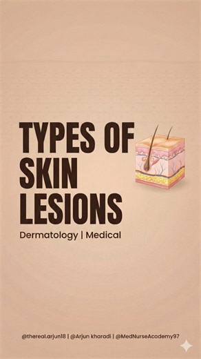 TYPES OF SKIN LESIONS 🩺🧴 Macule, papule, vesicle, pustule, plaque, ulcer & more — ye basic dermatology terms clinical identification aur exams ke liye must-know hain. 📌 Exam Tip: Flat = macule |