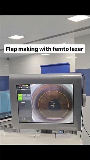Robotic femto LASIK is a laser eye surgery