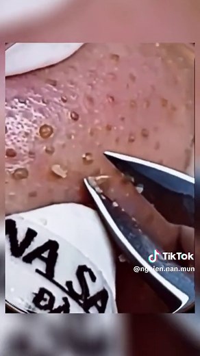 Làm Đẹp Khuôn Mặt trên TikTok