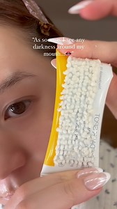 How I lighten the darkness around my mouth: Hyperpigmentation cream Using Celimax dark spot cream 5% Niacinamide, 5% Tranexamic Acid, and 1% Melazero V2, to fade darkness & hyperpigmentation #celimax #darkspots #hyperpigmentationtreatment mentation #skincare101 #glassskin #glowyskin #acne #beauty #texturedskin | Song Of Skin