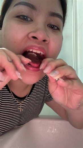another day, another reminder to use tongue scraper! 👅🤪 #tonguescraper #oralcare #oralhealth #oralroutine #badbreath #tonguescraperstainless #oralcareroutine