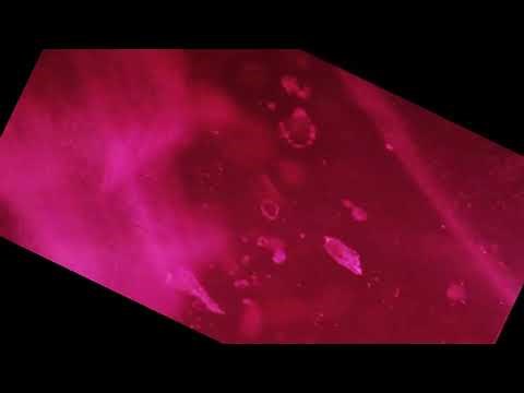burmese ruby under microscope