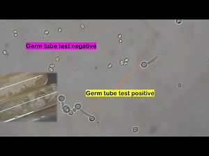 Yeasts and their GTT Tests