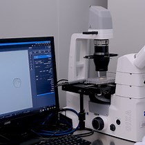 Video: Combined Conditional Knockdown and Adapted Sphere Formation Assay to Study a Stemness-Associated Gene of Patient-derived Gastric Cancer Stem Cells