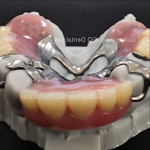 [Hot Item] Removable Dentures Co-Cr Alloy Framework Support Acrylic Teeth Economical Solution to Tooth Loss for Oral Restoration