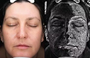 Does sunscreen increase the risk of skin cancer? Here's the science - GuardianTV