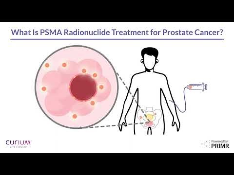 PSMA Prostate Cancer Treatment | Radioligand Therapy (RLT)