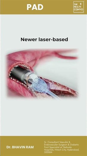 Blocked Arteries Treatment Without Bypass Surgery | Dr. Bhavin Ram Explains