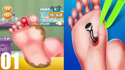 Foot Surgery Doctor Care Gameplay Walkthrough Level 01 - Android,Ios