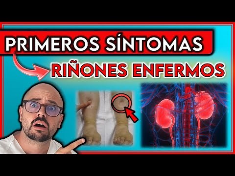 ESTOS son los 9 PRIMEROS SÍNTOMAS de unos RIÑONES ENFERMOS || Indican INSUFICIENCIA RENAL