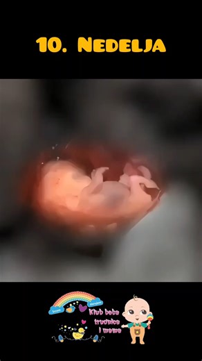 Da li znate kako izgleda embrion u 10. nedelji trudnoće? U 10. nedelji trudnoće dešavaju se neverovatne promene. Embrion je sada dug oko 3–4 cm, a težak svega nekoliko grama, ali u tom malom telu već postoji čitav jedan mali svet u razvoju. Glava je i dalje veća u odnosu na telo, ali su ruke i noge jasno formirane, prsti su odvojeni, a počinju da se razvijaju i nokti. Srce već uveliko kuca, mozak se intenzivno razvija, a unutrašnji organi zauzimaju svoje mesto. Na videu koji delimo možete videti