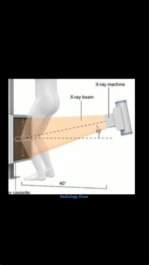 Knee x ray and positioning